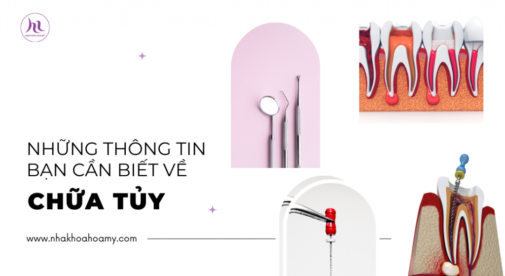 nhung-thong-tin-ve-chua-tuy