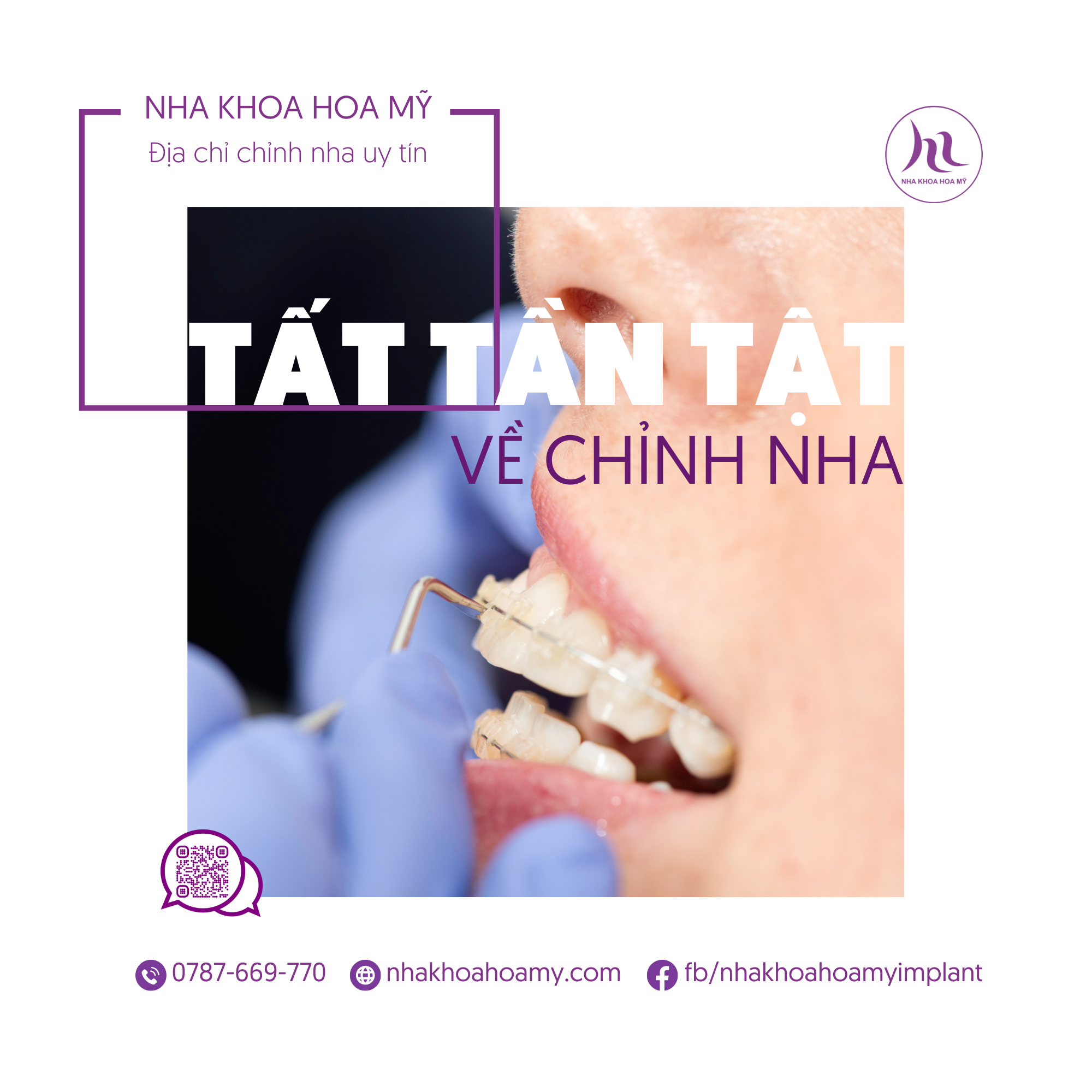 chỉnh nha