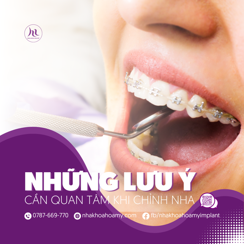 chỉnh nha
